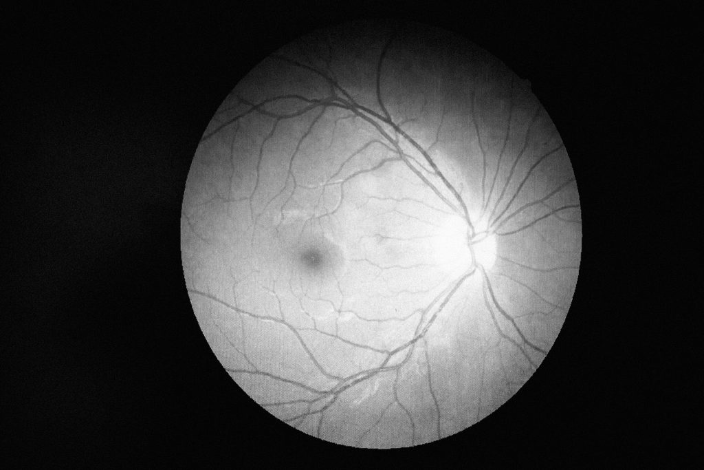 Photograph of the back of my eye